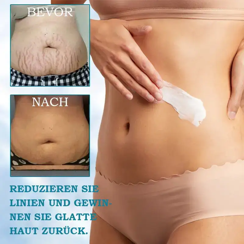 🌸Ringminds® 𝐀𝐝𝐯𝐚𝐧𝐜𝐞𝐝 𝐅𝐢𝐫𝐦𝐢𝐧𝐠 & 𝐖𝐫𝐢𝐧𝐤𝐥𝐞-𝐑𝐞𝐝𝐮𝐜𝐢𝐧𝐠 𝐂𝐫𝐞𝐚𝐦 Pro