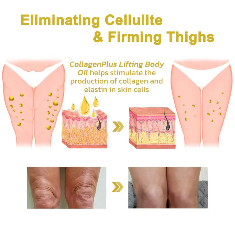 🌸Ringminds® 𝐀𝐝𝐯𝐚𝐧𝐜𝐞𝐝 𝐅𝐢𝐫𝐦𝐢𝐧𝐠 & 𝐖𝐫𝐢𝐧𝐤𝐥𝐞-𝐑𝐞𝐝𝐮𝐜𝐢𝐧𝐠 𝐂𝐫𝐞𝐚𝐦 Pro