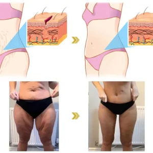 🌸Ringminds® 𝐀𝐝𝐯𝐚𝐧𝐜𝐞𝐝 𝐅𝐢𝐫𝐦𝐢𝐧𝐠 & 𝐖𝐫𝐢𝐧𝐤𝐥𝐞-𝐑𝐞𝐝𝐮𝐜𝐢𝐧𝐠 𝐂𝐫𝐞𝐚𝐦 Pro