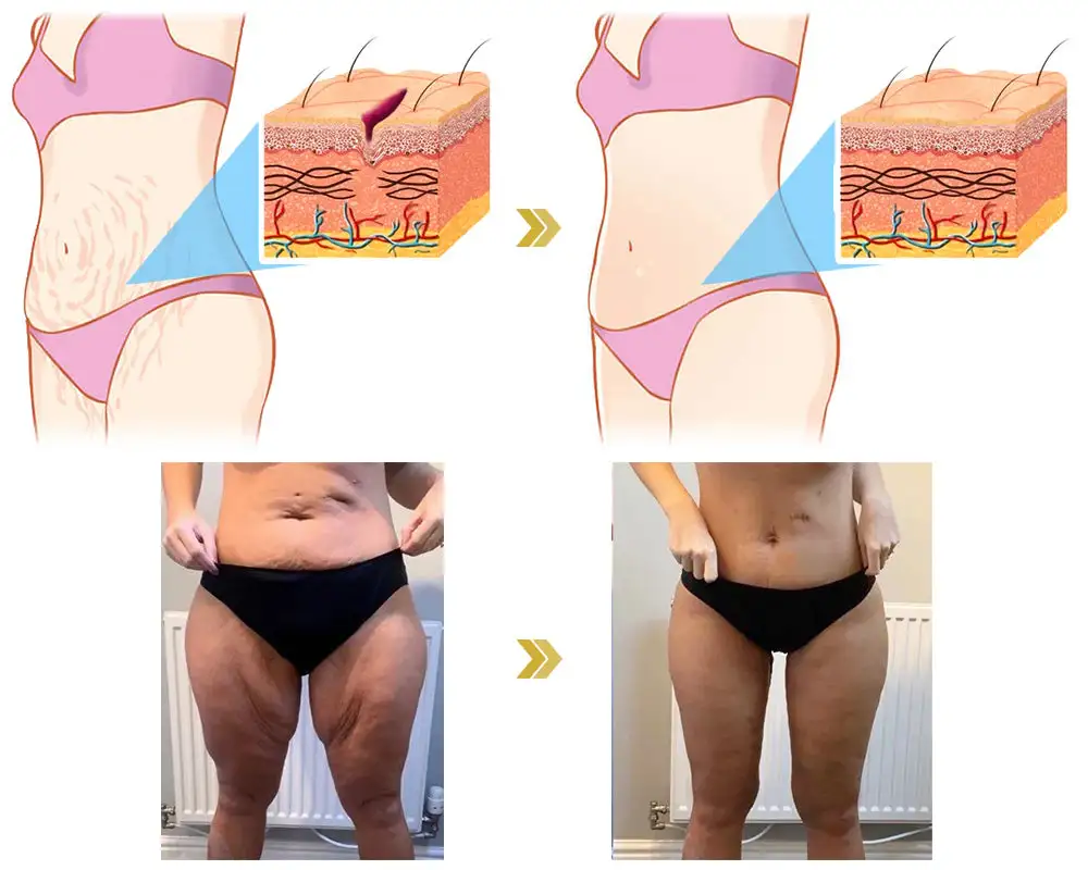 🌸Ringminds® 𝐀𝐝𝐯𝐚𝐧𝐜𝐞𝐝 𝐅𝐢𝐫𝐦𝐢𝐧𝐠 & 𝐖𝐫𝐢𝐧𝐤𝐥𝐞-𝐑𝐞𝐝𝐮𝐜𝐢𝐧𝐠 𝐂𝐫𝐞𝐚𝐦 Pro