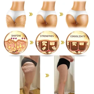 🌸Ringminds® 𝐀𝐝𝐯𝐚𝐧𝐜𝐞𝐝 𝐅𝐢𝐫𝐦𝐢𝐧𝐠 & 𝐖𝐫𝐢𝐧𝐤𝐥𝐞-𝐑𝐞𝐝𝐮𝐜𝐢𝐧𝐠 𝐂𝐫𝐞𝐚𝐦 Pro