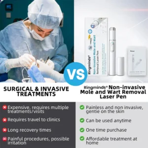 Ringminds® Non-invasive Mole & Wart Removal Laser Pen(Quick and painless removal of warts, moles, age spots, and skin tags with no side effects)