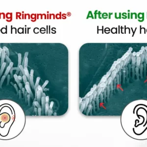 Ringminds® NeuroPulse Silence Pro